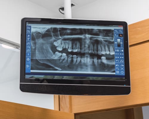 Dental Technology, Calgary Dentist